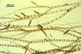 Ectocarpus siliculosus3